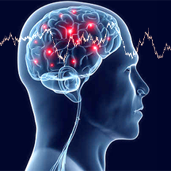 Neurology